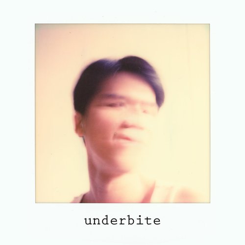 Underbite