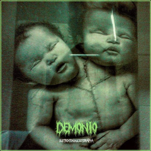 Eletroconvulsoterapia