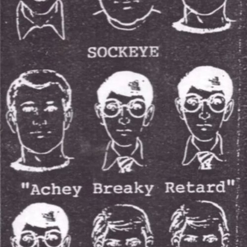 Achey Breaky Retard