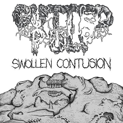 Swollen Contusion