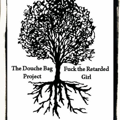 Split With The Douche Bag Project