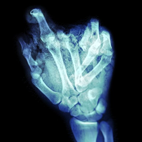 breaking the bones in my hands - Single