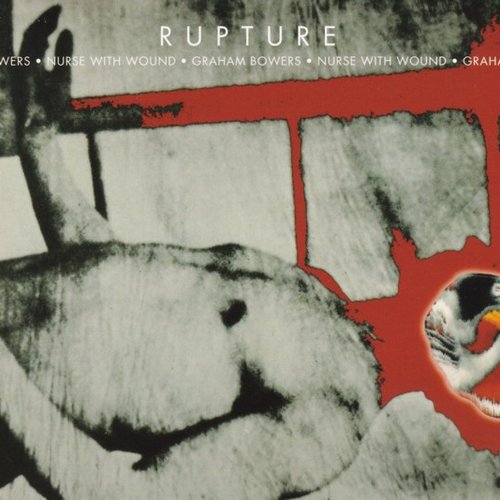 Rupture