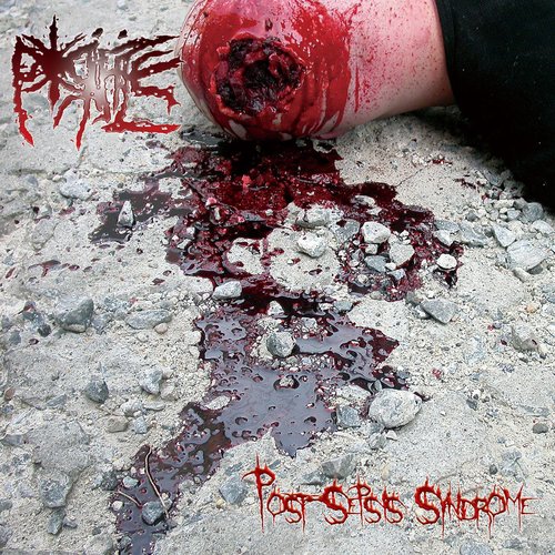 Post​-​Sepsis Syndrome
