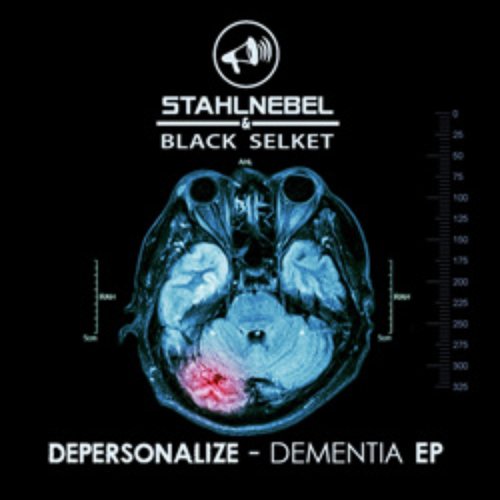 Depersonalize-Dementia