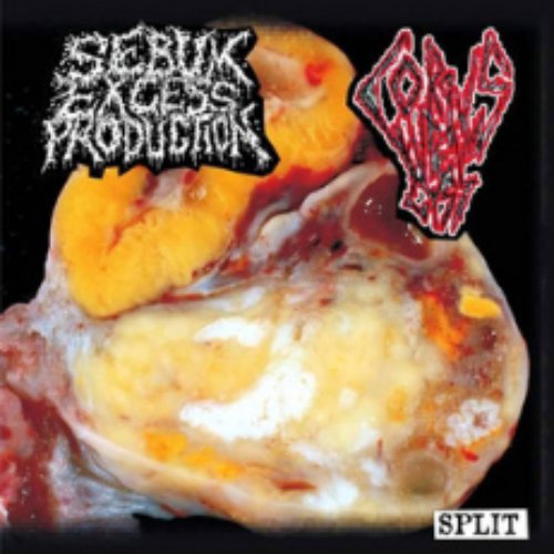 Tracks Off Split W/ Corpus Luteum Cyst