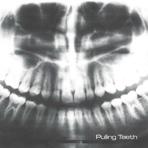 Pulling Teeth - Single