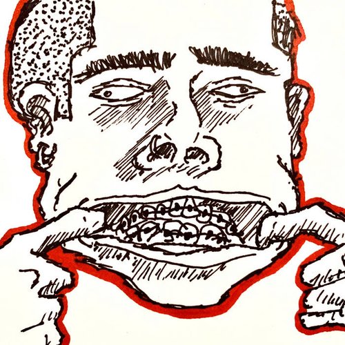 Braces - Single
