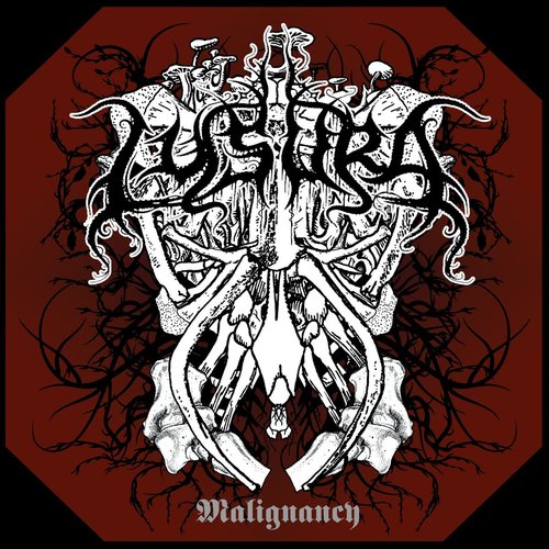 Malignancy