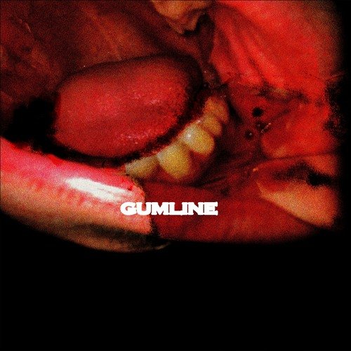 Gumline