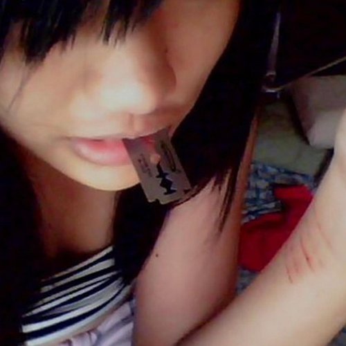 scars on my wrist