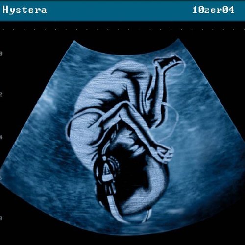 Hystera