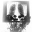 diaphragma