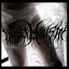 Corephallism