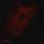 Mercurial Bloodstreams