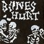 Bones Hurt