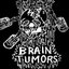 Brain Tumors