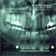 Too Many Teeth
