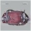 Outbreak EP