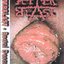 Rectal Desaster