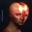 Tension Headache - Single