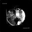 Heart Inside