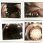 Taking Teeth: Volume 1