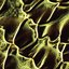 Sedimentation