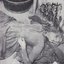 Gut / Morphea
