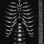 Thorax