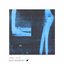 Ac Ep