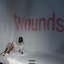 wounds