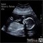 Obstetric Methods