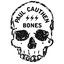 Bones