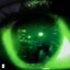 DOPAMINE - Single