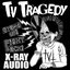 X-Ray Audio - Single