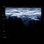 Reverberations