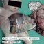 Fetal Alcohol Spectrum Disorders - Live in Querétaro
