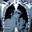 Hollow