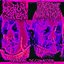 Cranial Decimation