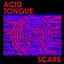 Scars