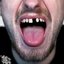 Drugs Booze & Dental Issues