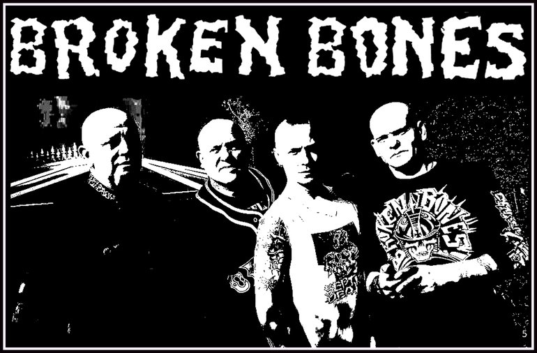 Broken Bones - Karl, Tezz, JJ, Bones 2012. 