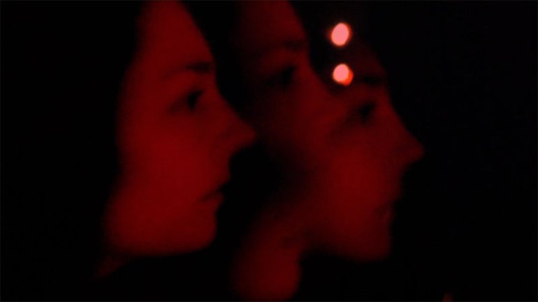ARTERY VIDEO 