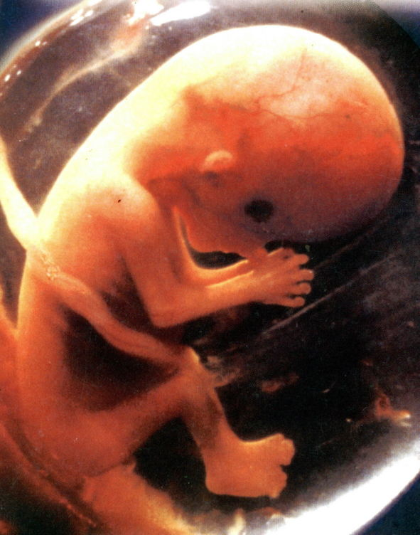 Десятка недели. Эмбрион на 10 неделе беременности.