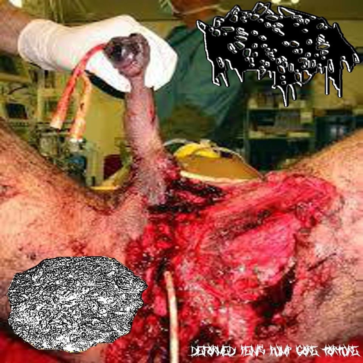 penis gore Deformed Penis Pump Gore Torture bilder och konst | Last.fm
