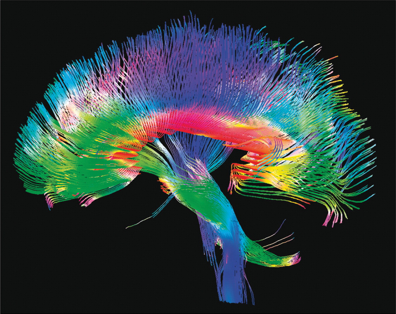 Проект головной мозг человека Brain :: Behance