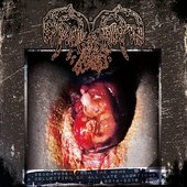 Decomposed From The Womb...A Collection Of All Late Abortions 2014-2016