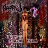 Extirpación Visceral