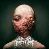Gonoclam - Single